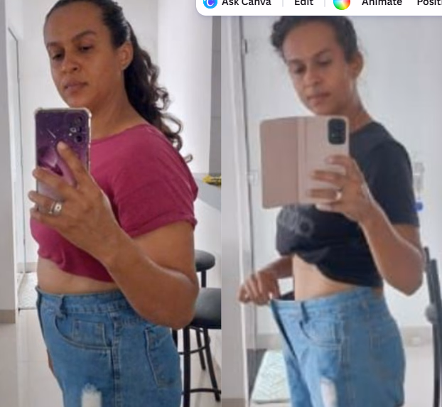 Cleudina — antes e depois com o Protocolo 5D
