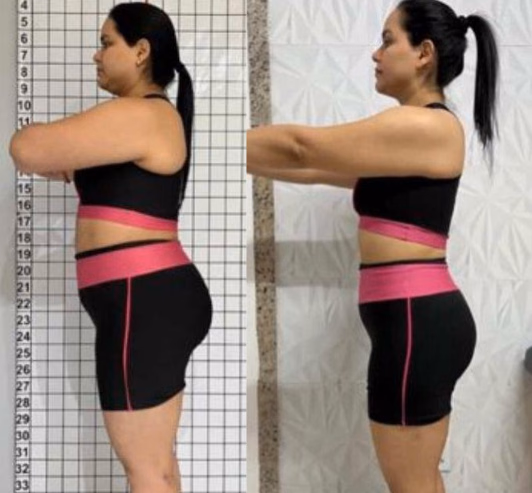 Ellen — antes e depois com o Protocolo 5D